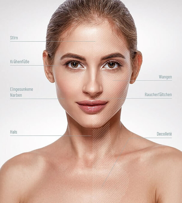 Hautverjüngung mit Skinbooster, Praxis Dermatologie München, Steinkraus Skin